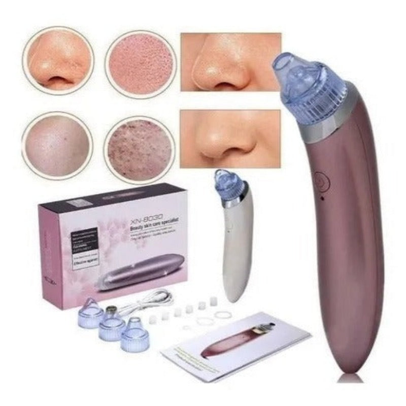 Extractor de Puntos Negros