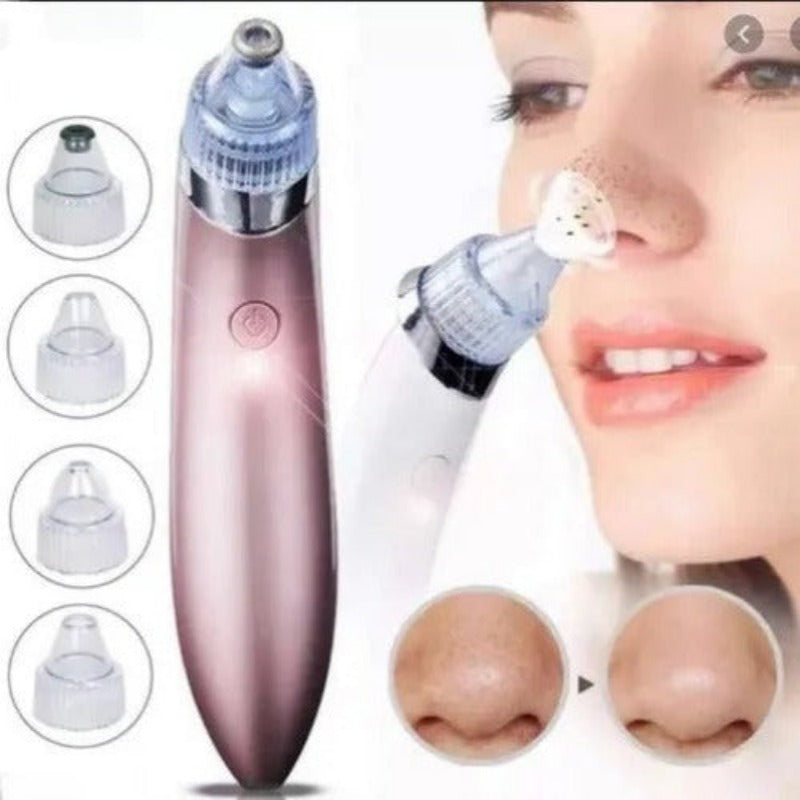 Extractor de Puntos Negros